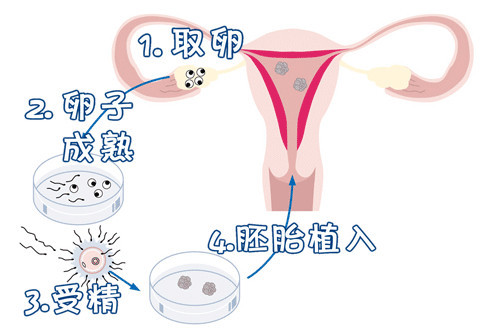 同志供卵代孕网